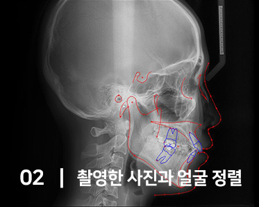 3D 시뮬레이션 정밀 진단 시스템