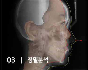 3D 시뮬레이션 정밀 진단 시스템