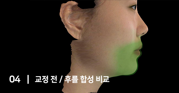 3D 시뮬레이션 정밀 진단 시스템