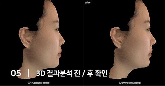 3D 시뮬레이션 정밀 진단 시스템